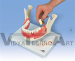 Dental disease, magnified 2 times, 21 parts